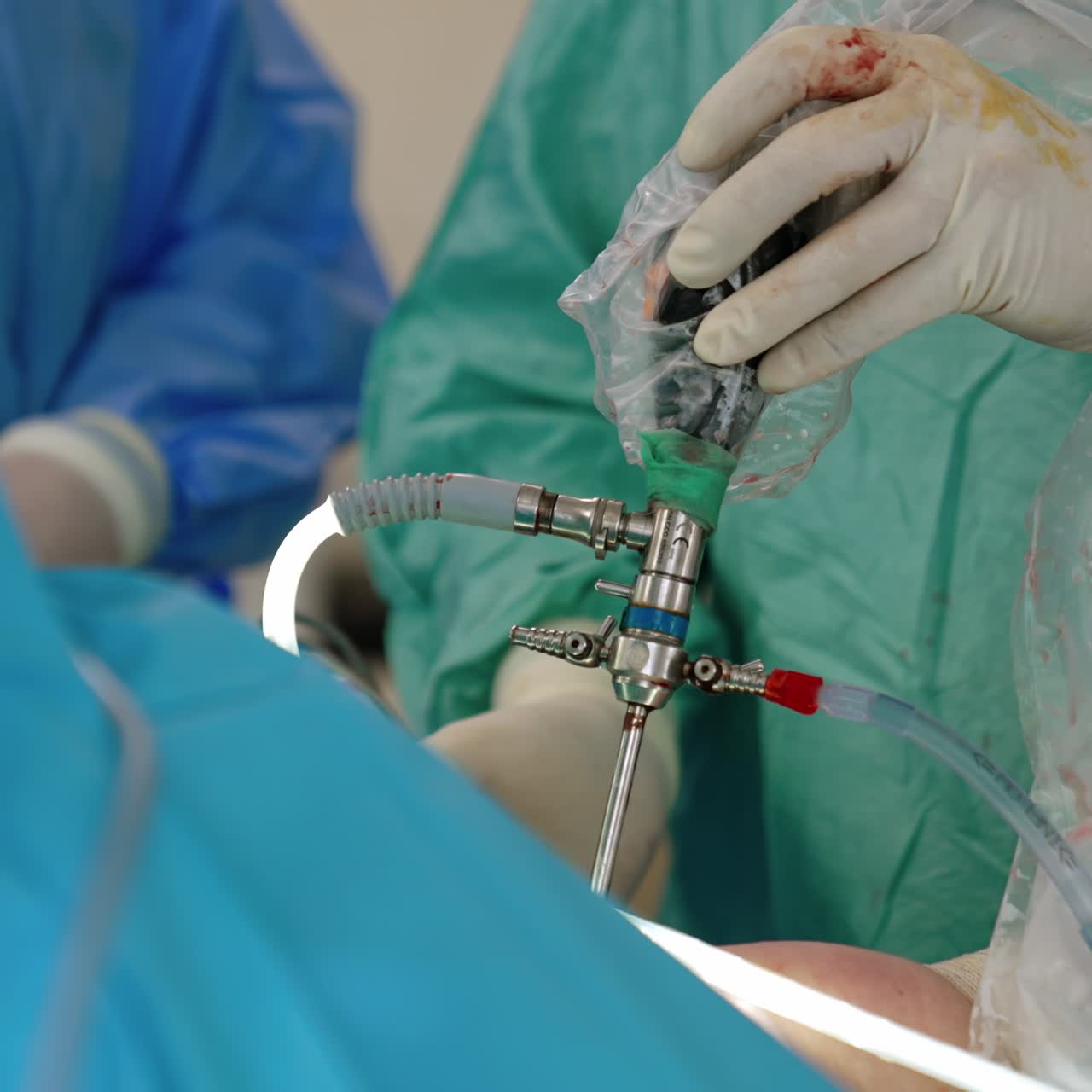 Hands of the surgeons hold the electric medical device moving it back and forth. Trauma healing operation close up