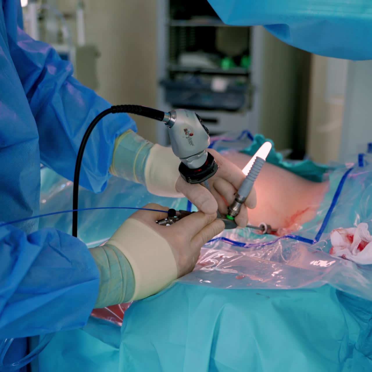 Surgeons at work operating in surgical theatre