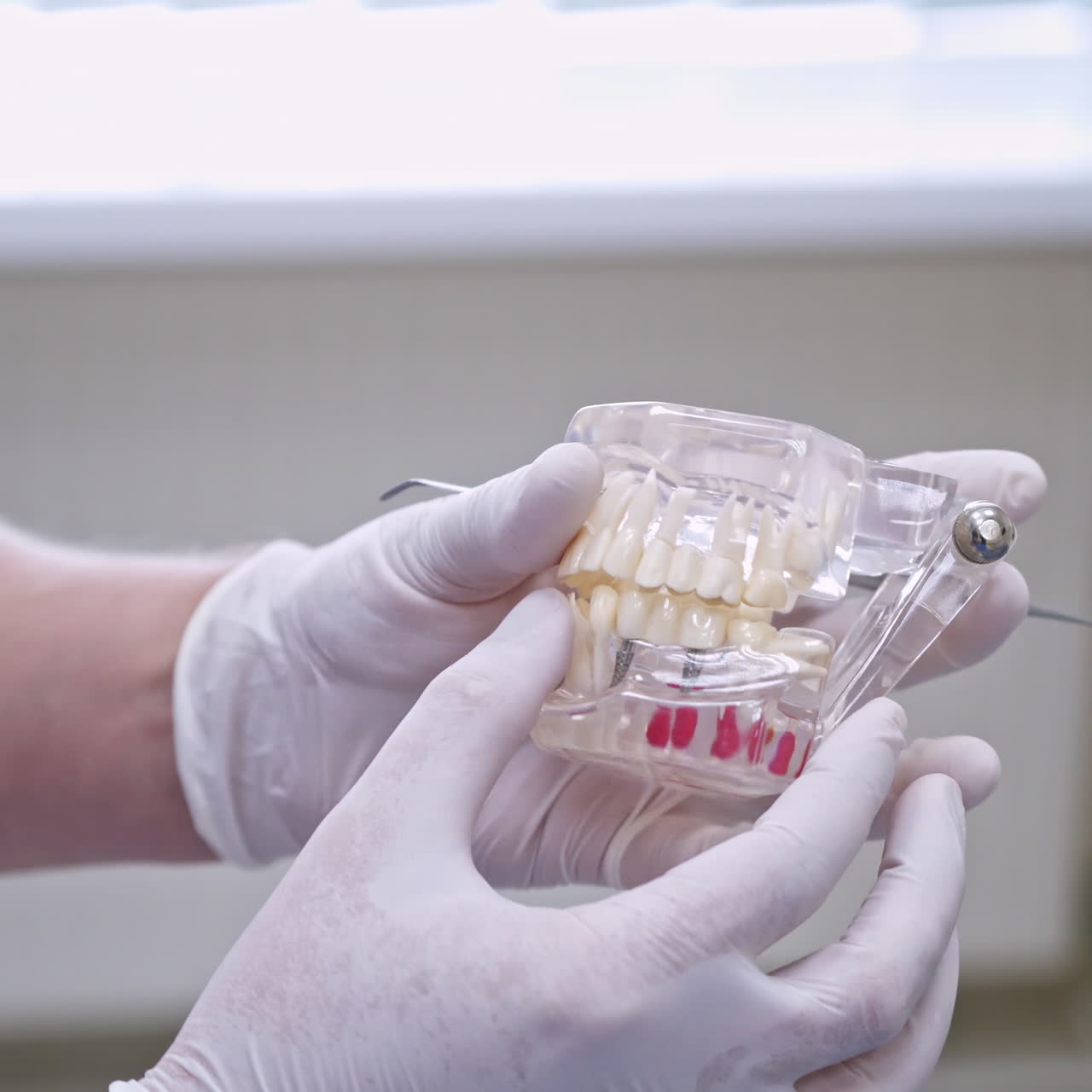 Doctor shows on a plastic jaw sample or model different methods of teeth treatment. Modern dental clinic background. Health concept. White medical gloves on male doctor's hands.