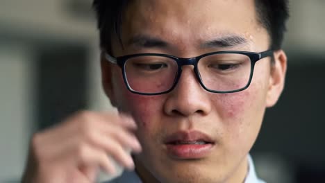 a young man appears to be in discomfort as he rubs his forehead while wearing glasses in an office environment. he seems to be concentrated, dealing with a challenge at work.