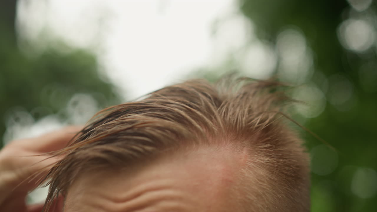 걱정스러운 표정으로 이마에 땀을 흘리며 머리를 감싸 쥐고, 가려운 두피를 긁는 불안한 백인 남성, 긴장되고 초조한 표정, 흐린 빛이 비치는 숲 배경, 스트레스 및 웰빙 관련 묘사를 위한 클로즈업 디테일