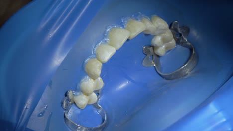 The transformative process of teeth cleaning and whitening as they're covered in this trending clinic footage