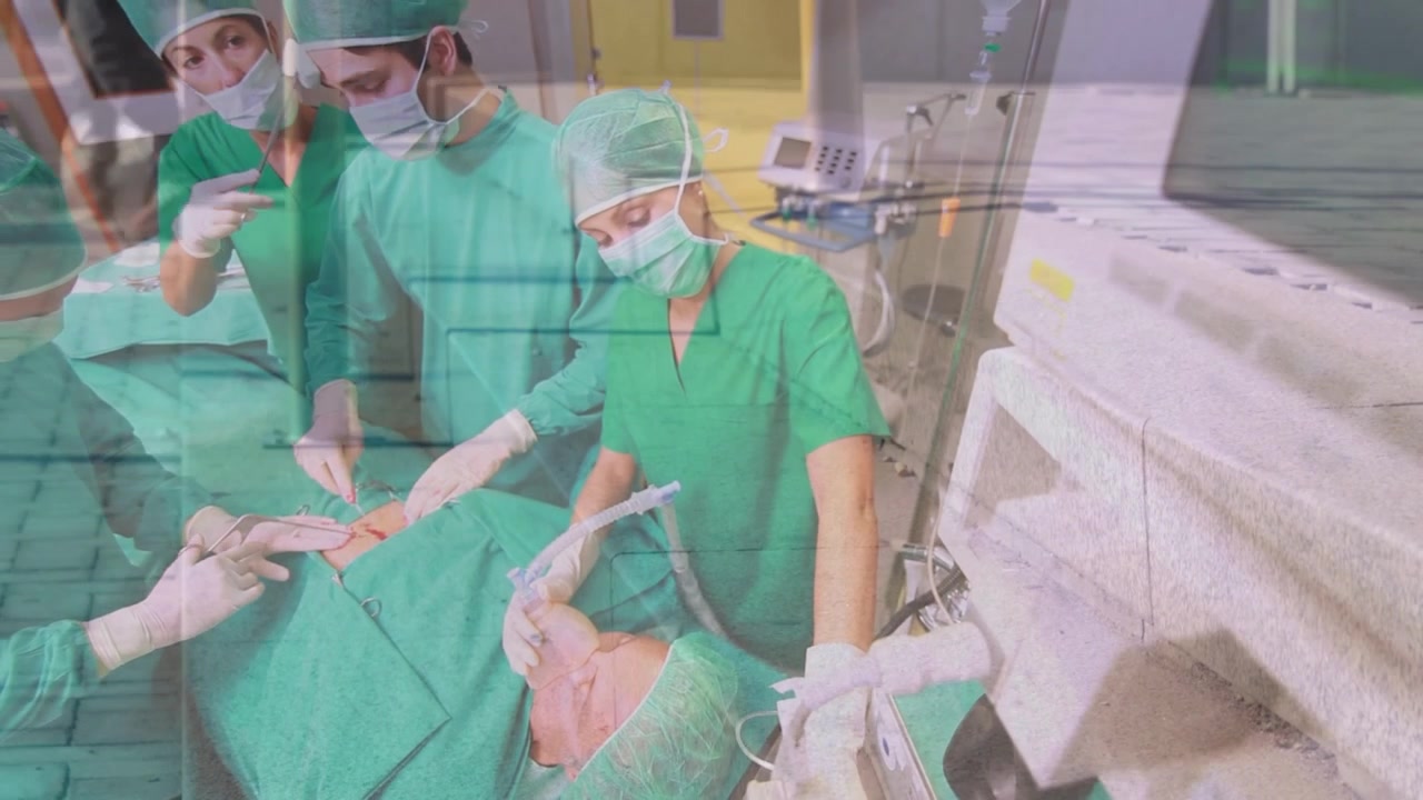Animazione di timelapse con persone che camminano su un team di chirurghi caucasici durante un'operazione