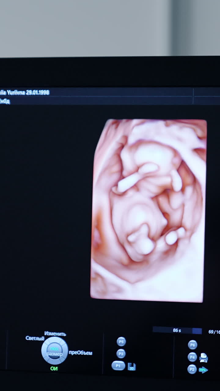 3d image of a baby in the mother's womb. Screen of ultrasonic equipment during examination of pregnant woman. Close up. Vertical video