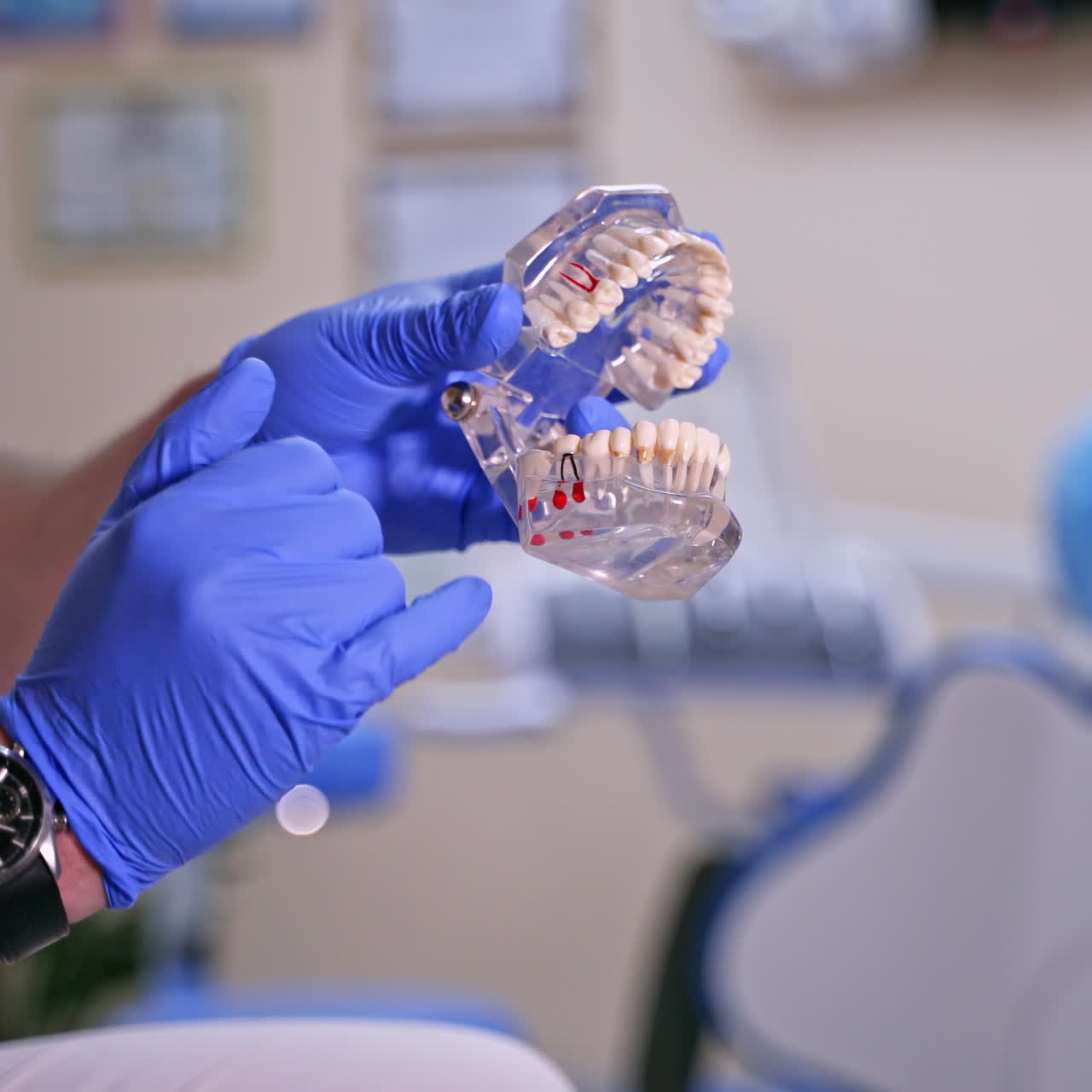 Doctor shows on a plastic jaw sample or model different methods of teeth treatment. Modern dental clinic background. Blue medical gloves on male doctor's hands. Dental Hygiene and Health concept video.