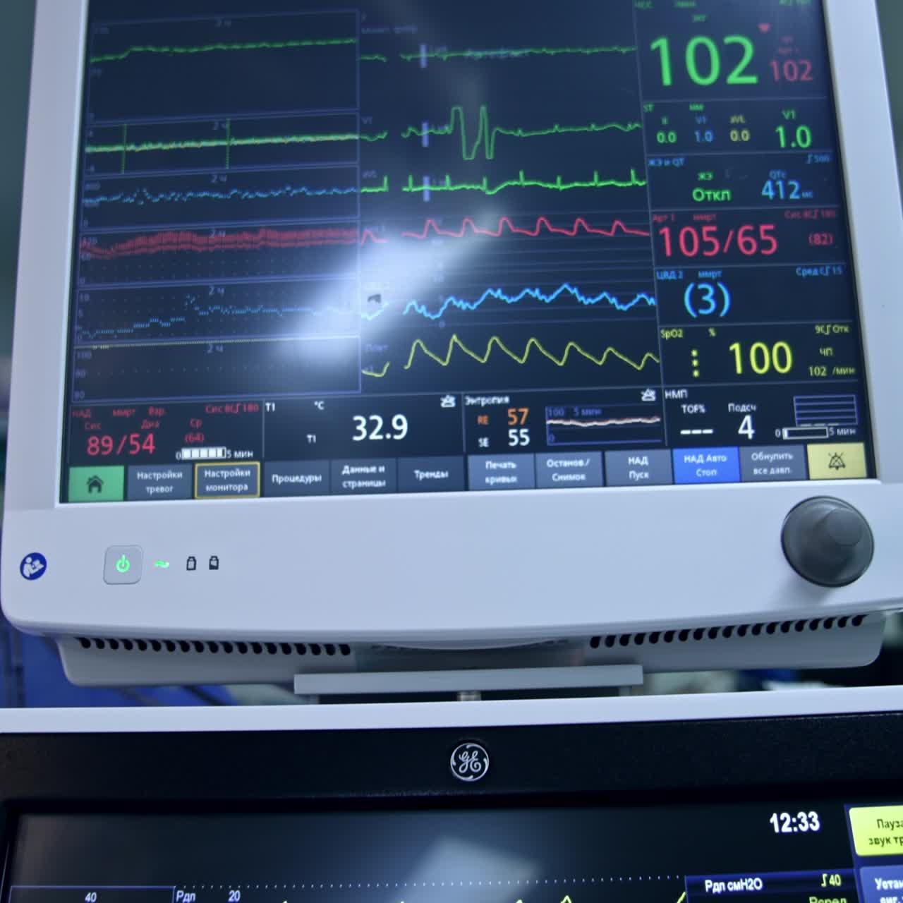 Curves and digits changing on the screen of lung ventilator. Monitoring the condition of patient under operation
