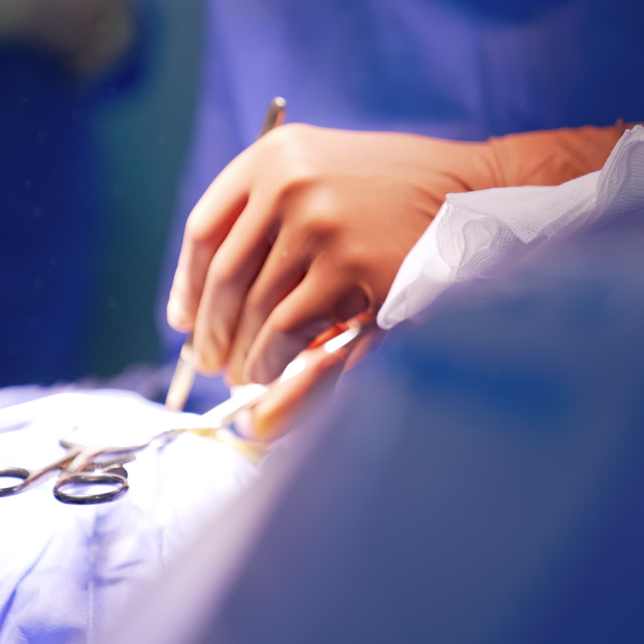 Concentrated male surgeon wearing surgical loupes looks down at patient. Doctor applies instruments at operation.