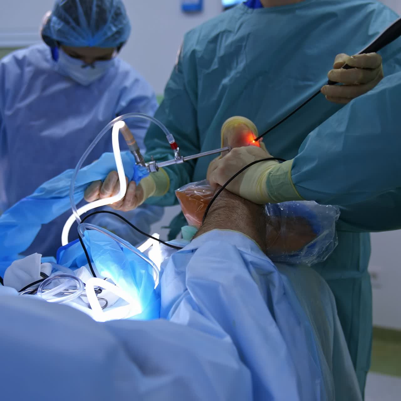 Group of surgeons in operating room with surgery equipment. Process of trauma surgery operation