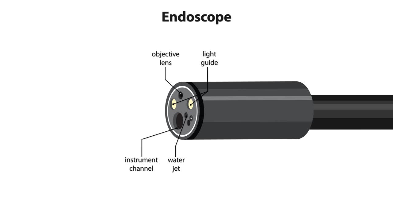 Medical endoscope tip rotates, labeling objective lens, light guide, channels, and deploying a snare tool