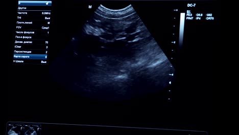 diagnóstico por ultrasonido en una clínica veterinaria