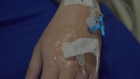 closed up of hand infused with intravenous line iv for receiving fluids,medicine