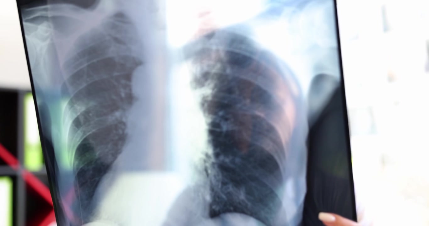 Una dottoressa con una radiografia in mano, primo piano.