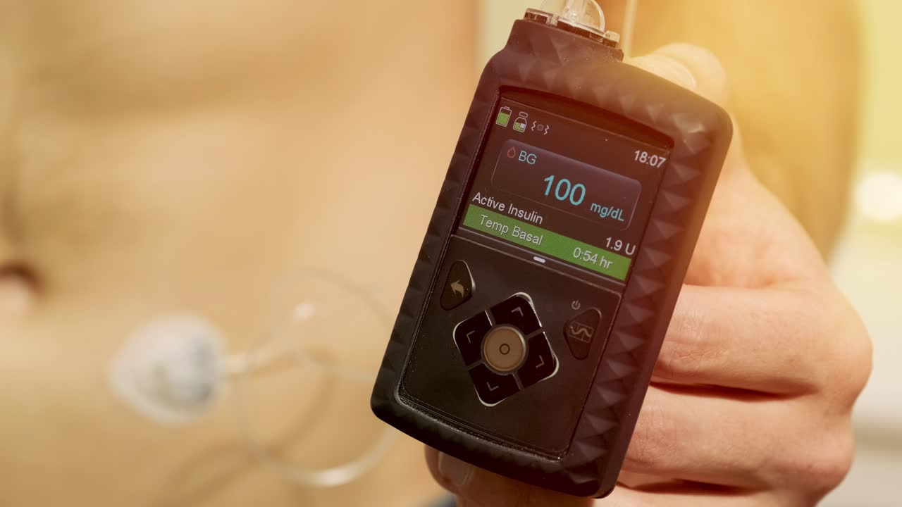 배에 인린 프를 연결하고 인린프를 손에 들고 있는 당뇨병 환자.