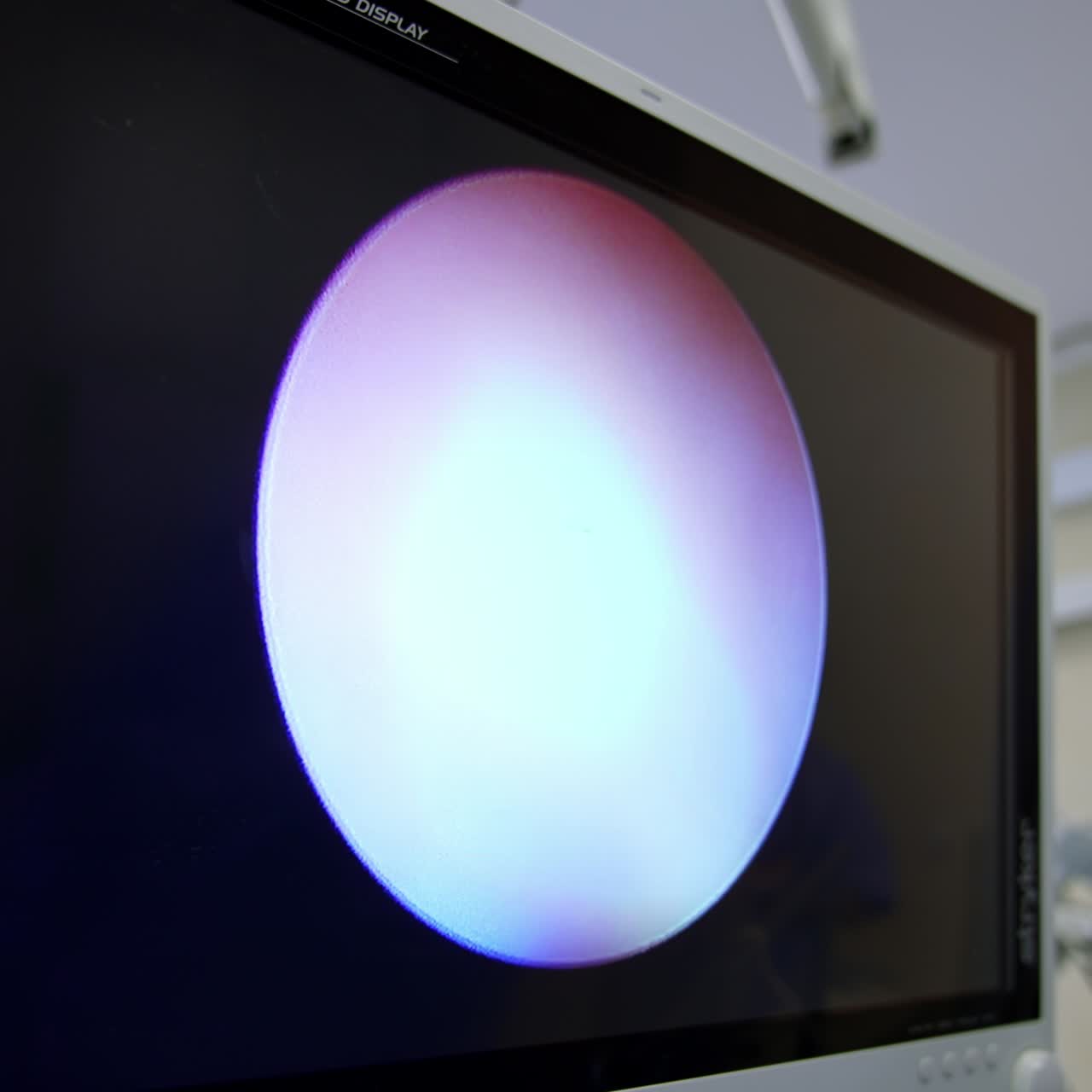 Operated area from inside on the screen of big monitor hanging in the surgical room. Close up