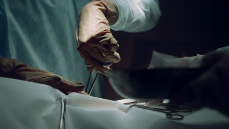 surgeon hands using clamp operating room closeup. hospital intensive care unit.