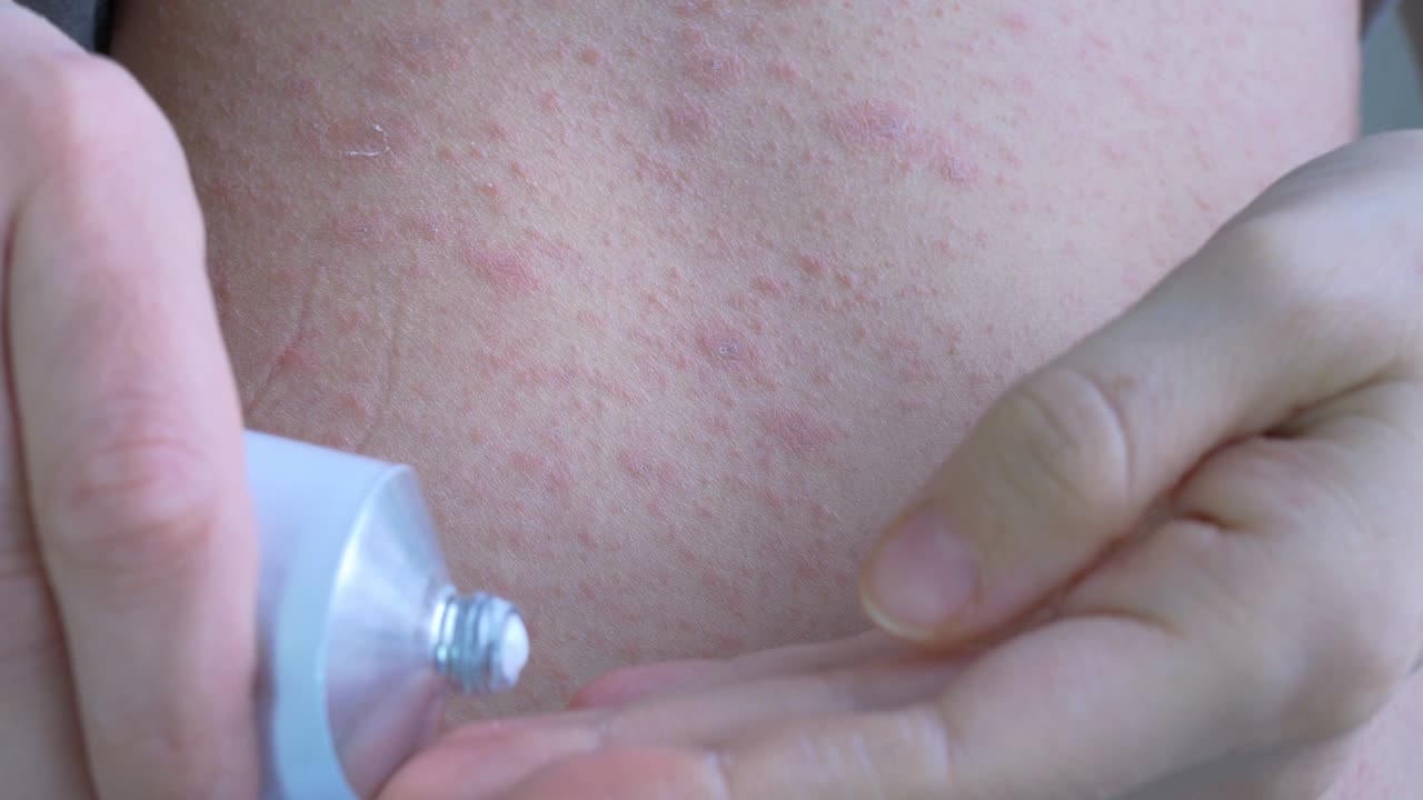 la ropa doméstica en el cuerpo se levanta a mano, luego el lado derecho de la cavidad abdominal con manchas enrojecidas se mancha con ungüento y se frota en movimientos circulares.