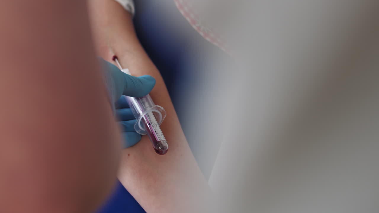 Concetto di assistenza sanitaria in laboratorio in clinica: assistente di laboratorio che preleva sangue venoso per test clinici