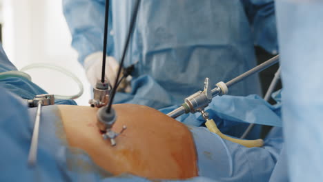 cirugía abdominal laparoscópica
