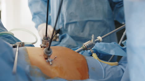 laparoscopic abdominal surgery