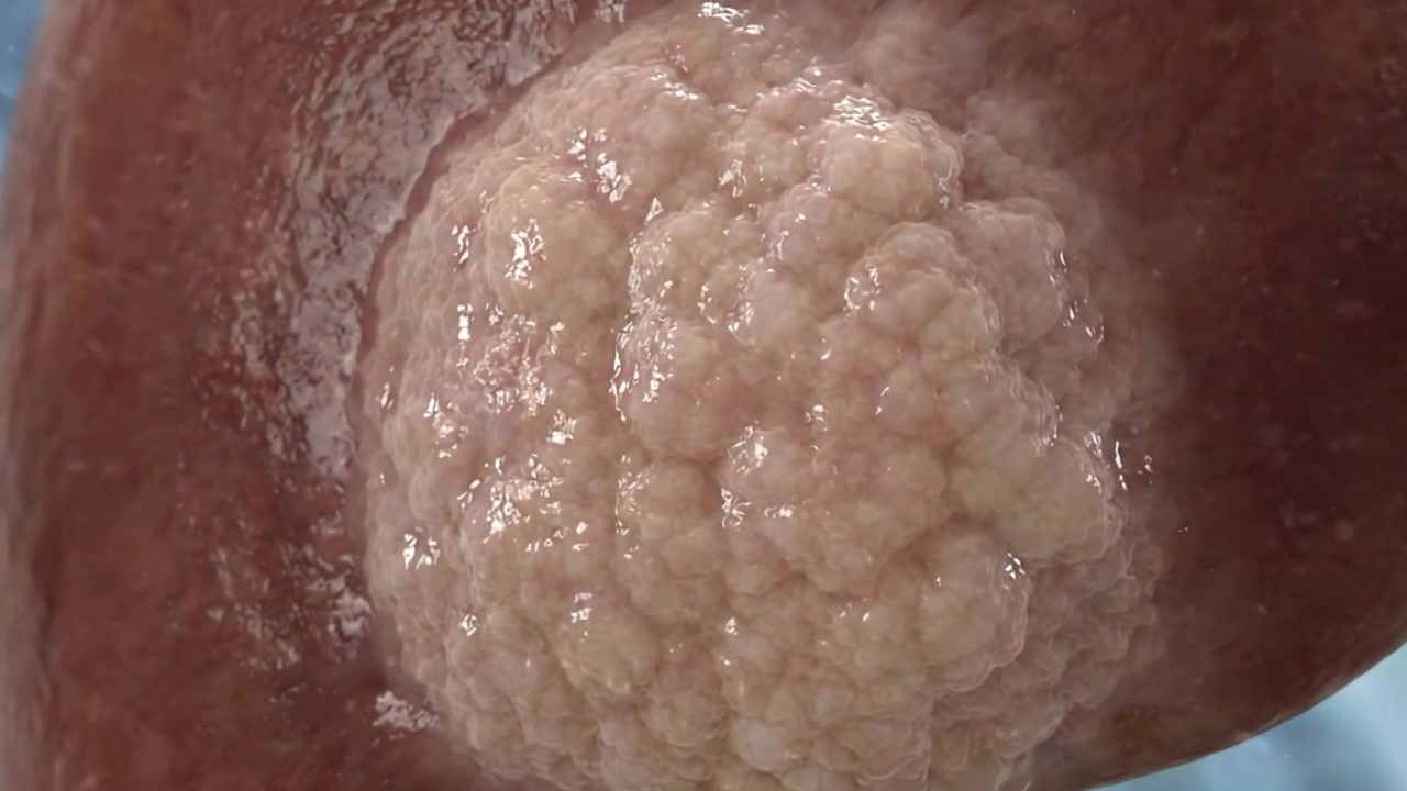 Vista ravvicinata della superficie testurizzata del fegato umano in una visualizzazione medica realistica