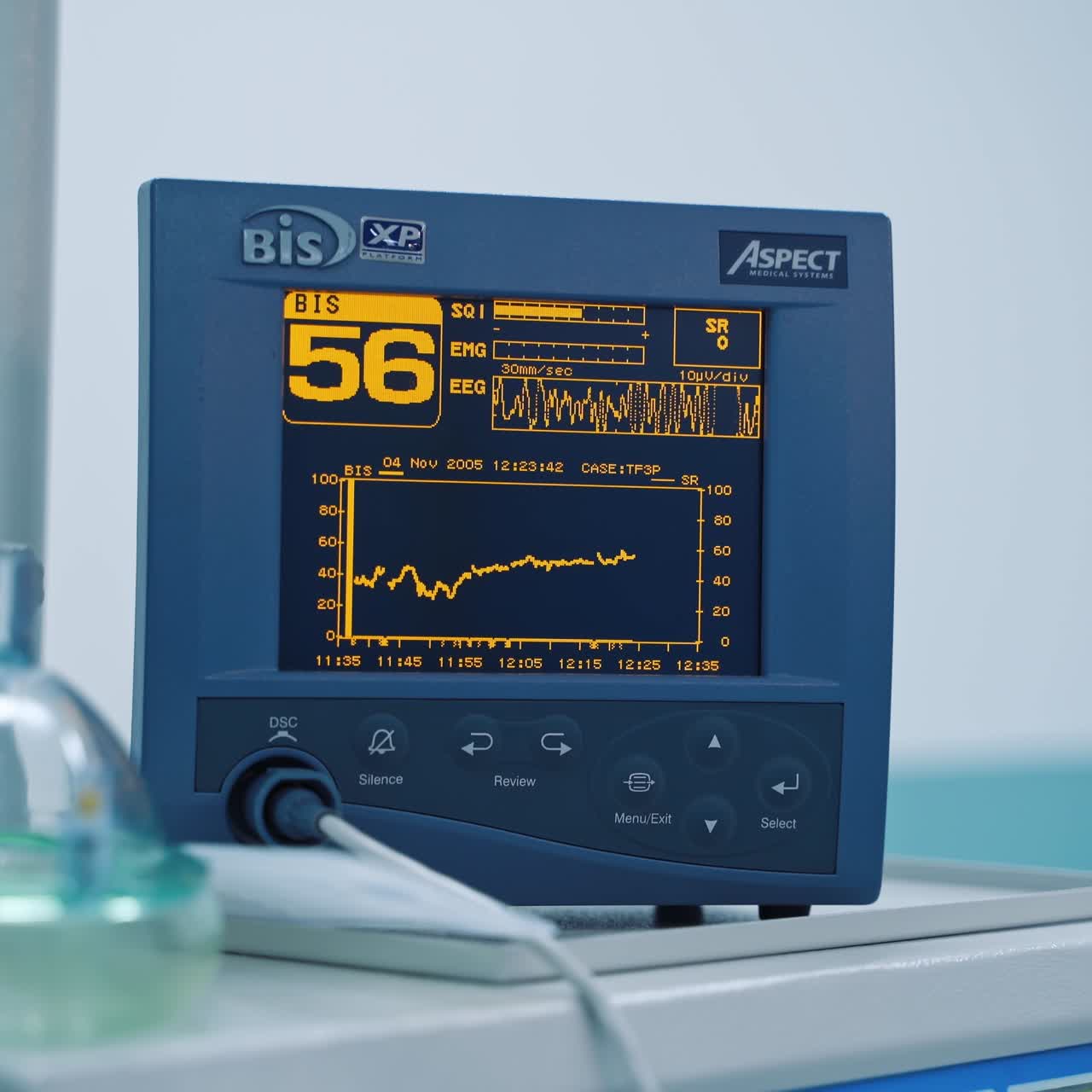 Mechanical Lung ventilation in intensive care unit. Vital signs monitor in hospital