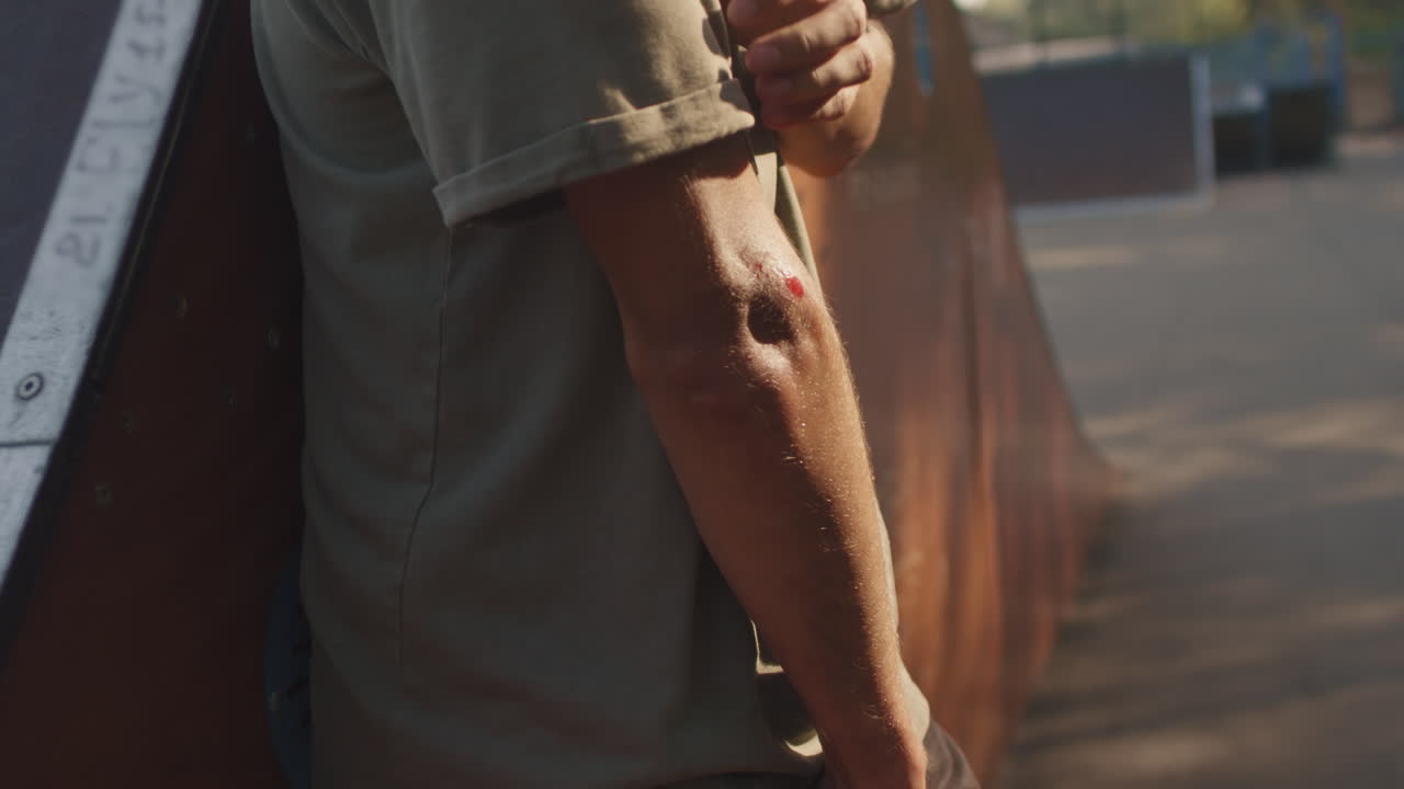 Close Up of Skater Looking at Injury