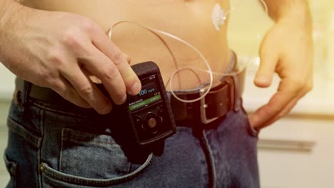 diabetic man with an insulin pump connected in his abdomen and holding the insulin pump at his hands. diabetes concept.