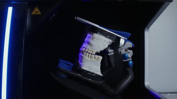 3D Scanning of Dental Model