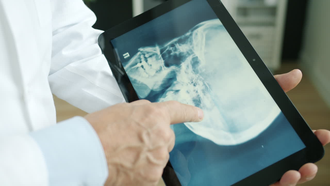 Doctor reviewing skull x-ray on tablet