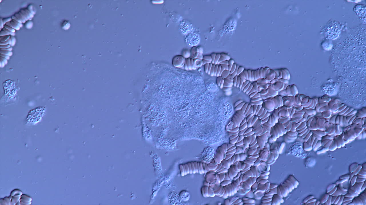 Microscopic View of Blood Cells and Aggregates