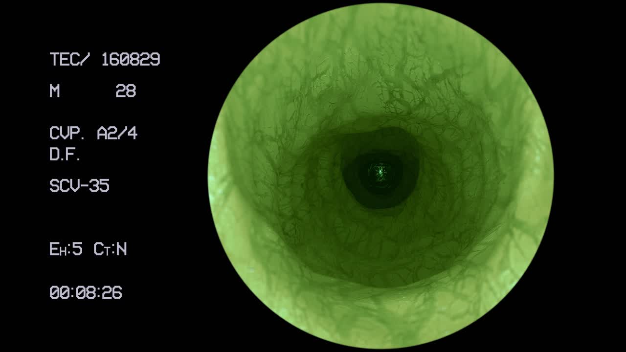 외계인 내시경 내장 할로윈 초자연적 과학 생물 후두 탐사선 ufo 4k