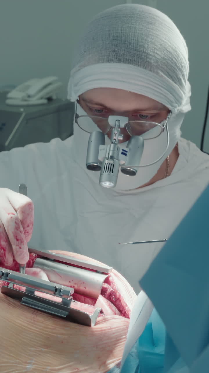 médico durante un procedimiento cardíaco con láser. el cirujano realiza una cirugía de derivación de la arteria coronaria en una sala de operaciones moderna utilizando un bisturí láser para una mayor precisión