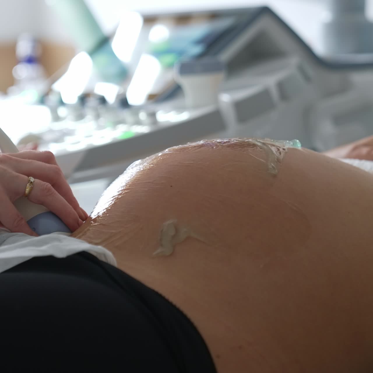 Pregnant woman having ultrasound check up. Doctor's hand moves the sensor by the belly covered with gel