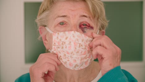 mujer anciana angustiada con ojo morado usando máscara facial concepto de alto riesgo