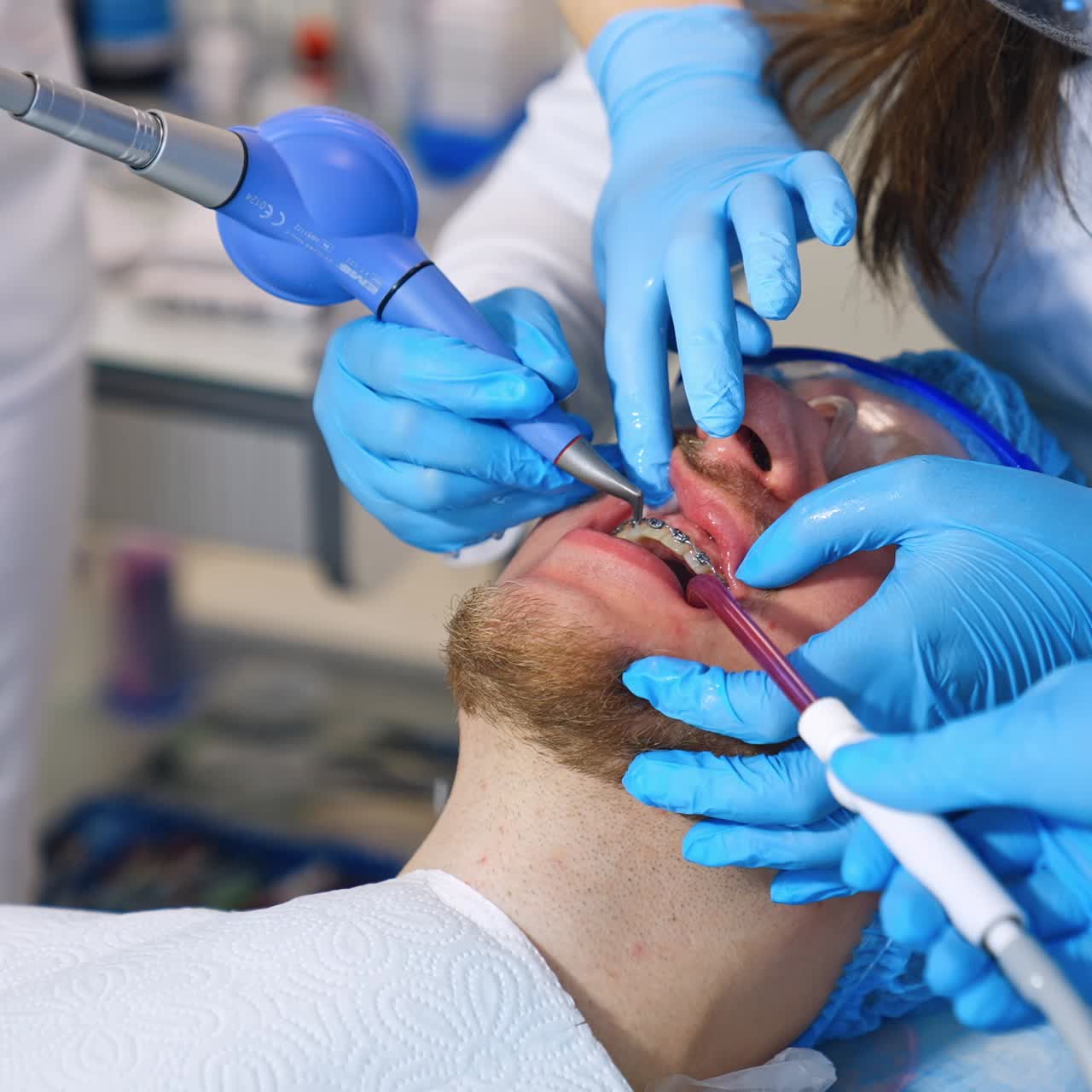 Cura dentale per il paziente con sistema di bracket. Primo piano. Studenti che frequentano un corso di ortodonzia