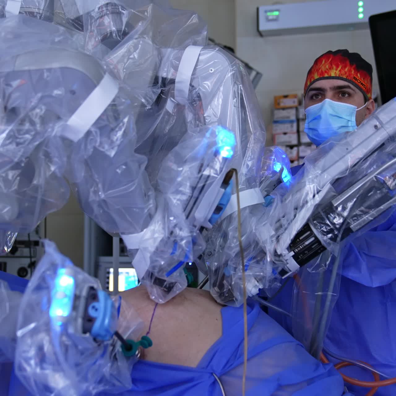 Surgical robot carries out laparoscopy in modern hospital. Doctor in colorful cap watches the procedure intently on the screen