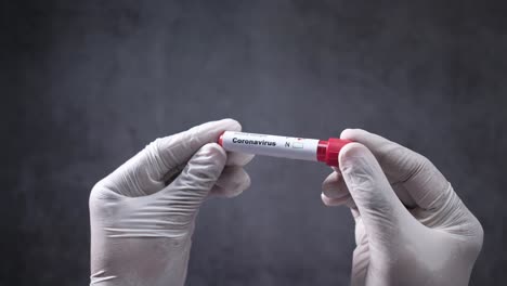 prueba de muestra de sangre de coronavirus