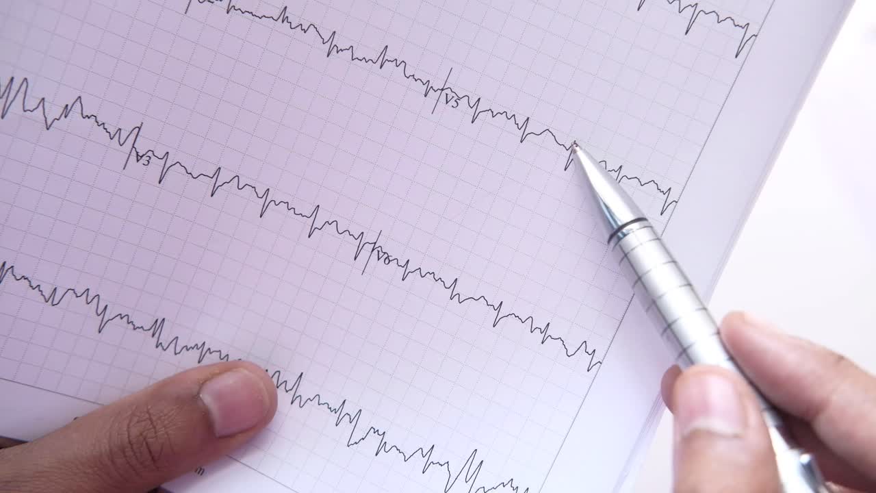 ecg 차트