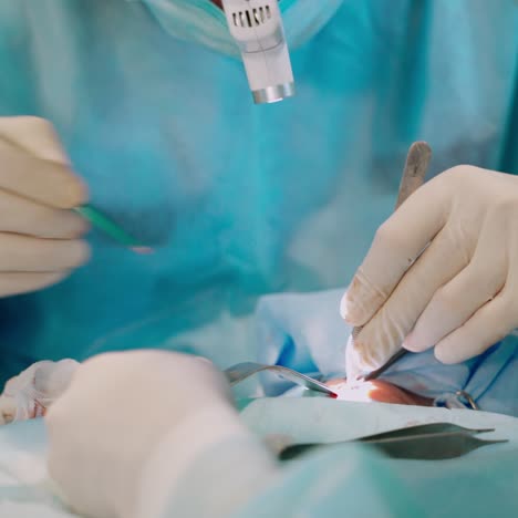equipo médico que realiza una cirugía