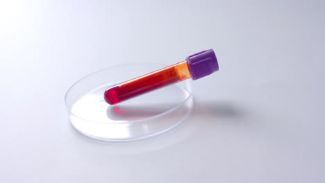 primer plano de una muestra de sangre y una placa de petri sobre un fondo blanco con espacio de copia, cámara lenta