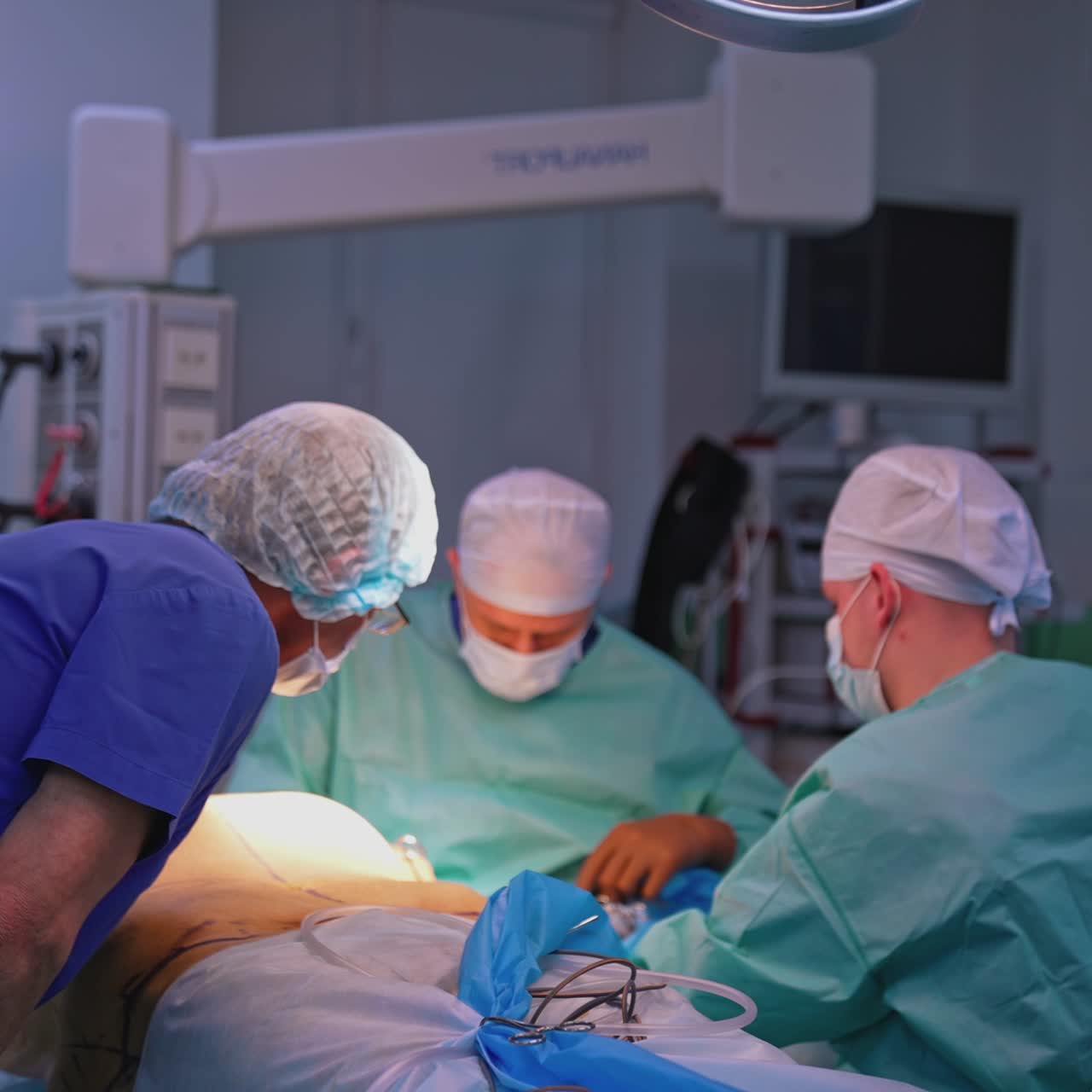 Group of medical specialists in the operating room. Doctors and nurses perform a plastic surgery to a patient in the hospital. Assistant with medical tools