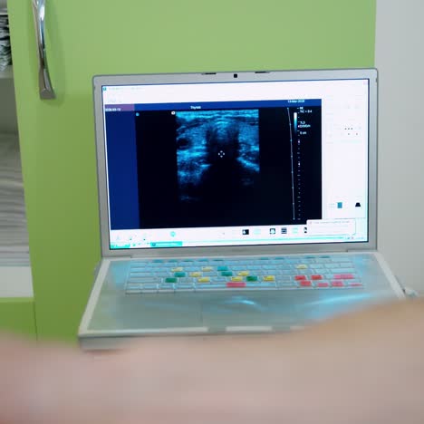 ultrasound research on the screen. monitor shows the results of scanning patient's organs during ultrasound diagnostic in clinic.