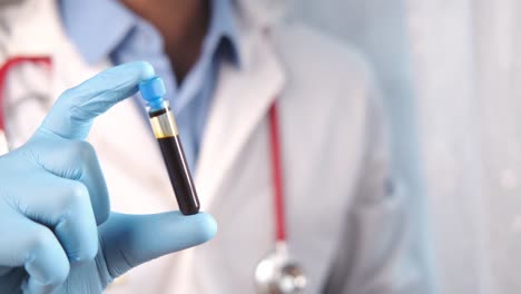médico con un tubo de ensayo de muestra de sangre