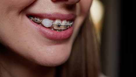 woman with braces