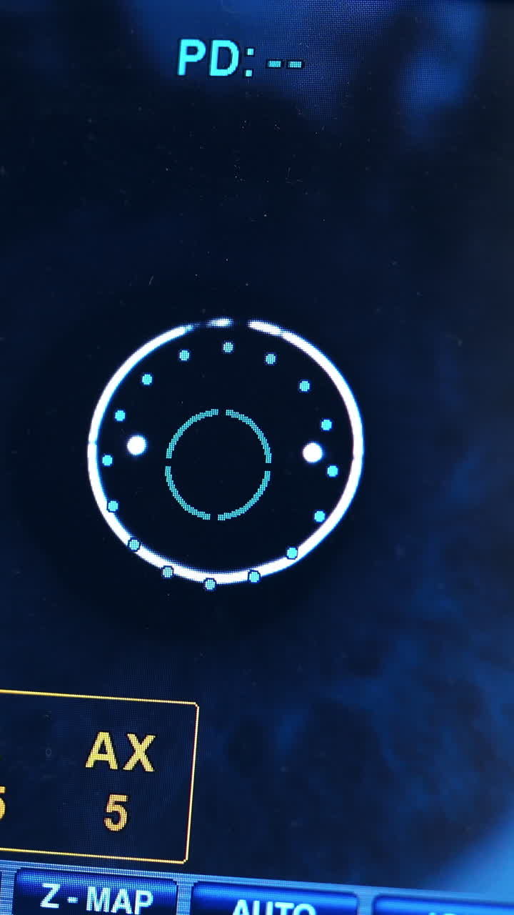 Eye operation monitor. Modern medical equipment in eye hospital. Vertical video