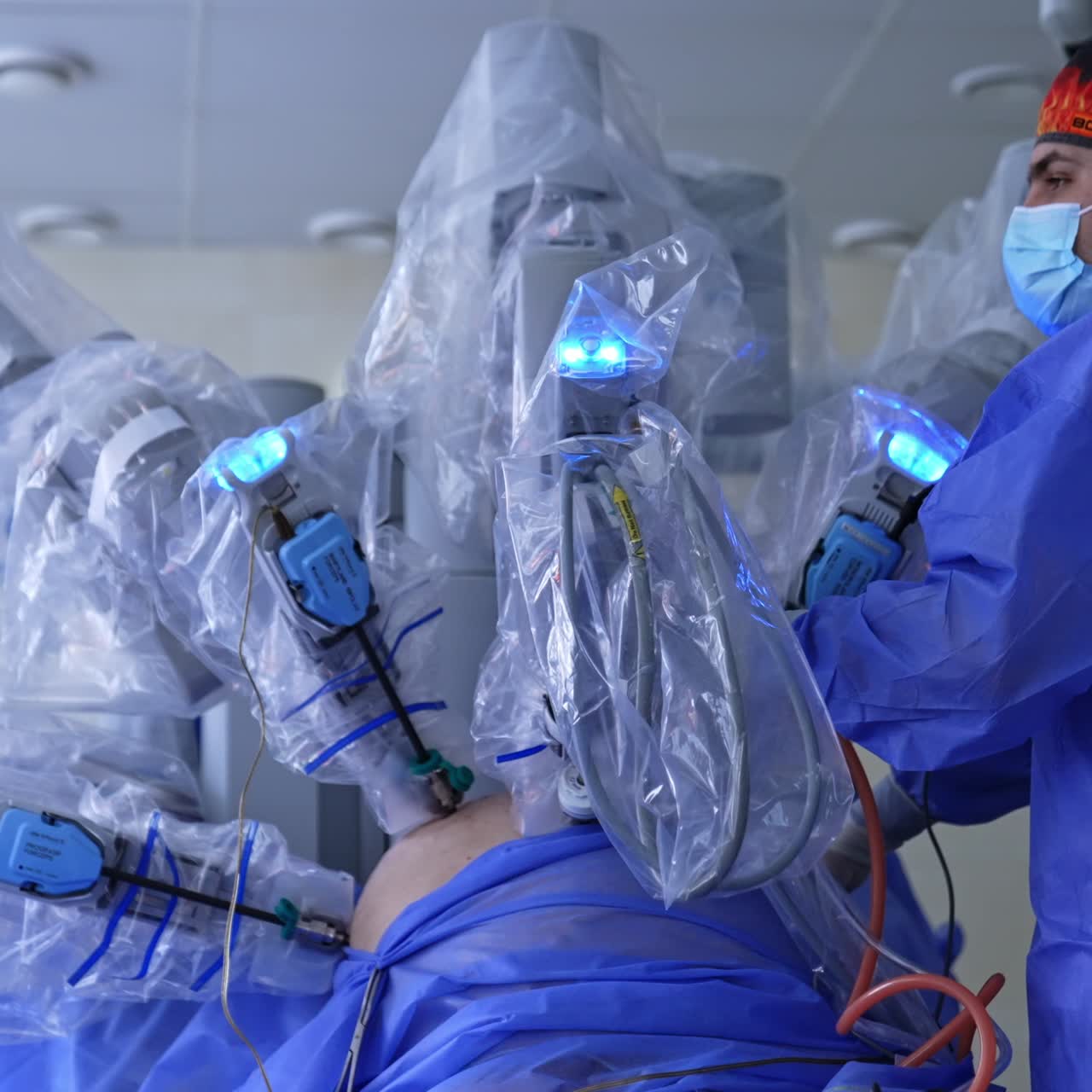 Doctor and robot cooperate at operation. Robotic arms move slowly and the surgeon watches the process on the monitor