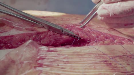 surgeon sutures the wound after the operation close-up