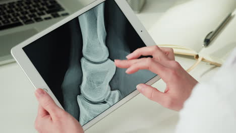 veterinary x-ray of horse's leg