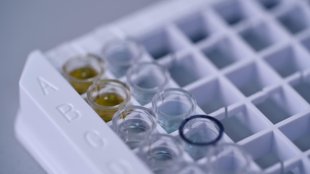 Medical equipment for blood test. Form to fill in the results of biochemistry blood tests