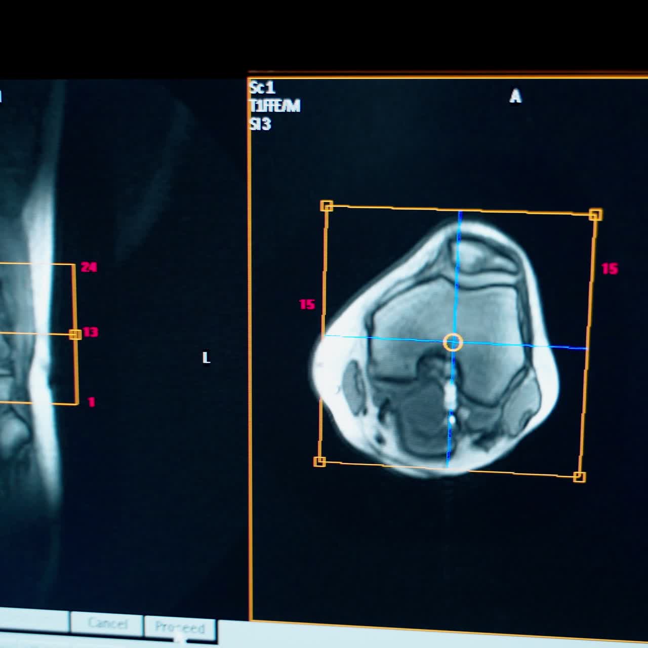 X-rays on a computer screen in a laboratory room. Doctor radiologist examines radiographic shots of the patient's bones on the screen of a monitor.